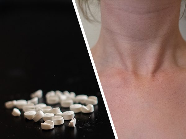 Levaxin är standardbehandlingen vid underfunktion i sköldkörteln. Under 2018 behandlades nära en halv miljon för hypotyreos.